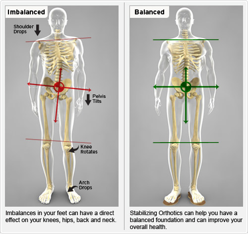 orthotics.jpg