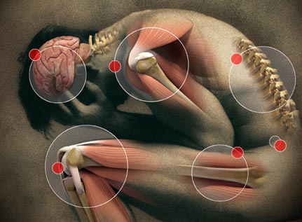 pain-map.jpg